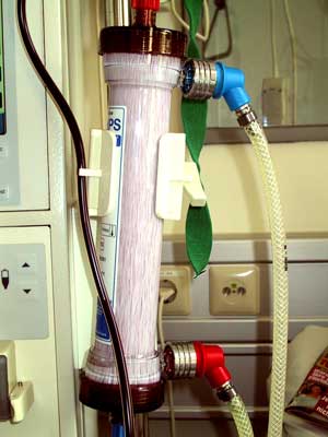 dialysator-an-maschine