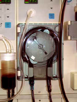 rollenpumpe-dialysemaschine